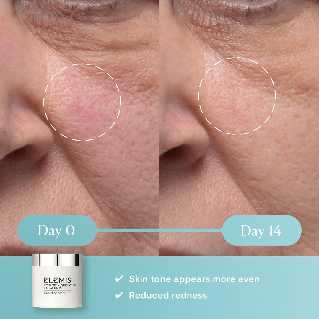 ELEMIS Dynamic Resurfacing Facial Pads